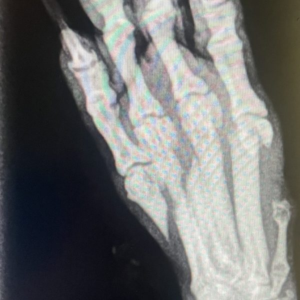 54